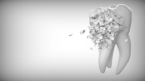 hambajuurte eemaldamine - igemete taastamine